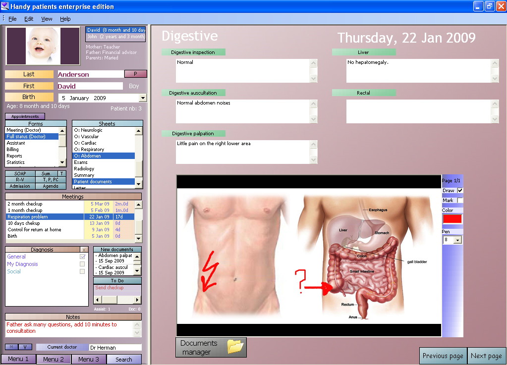 Early versions of EHR systems